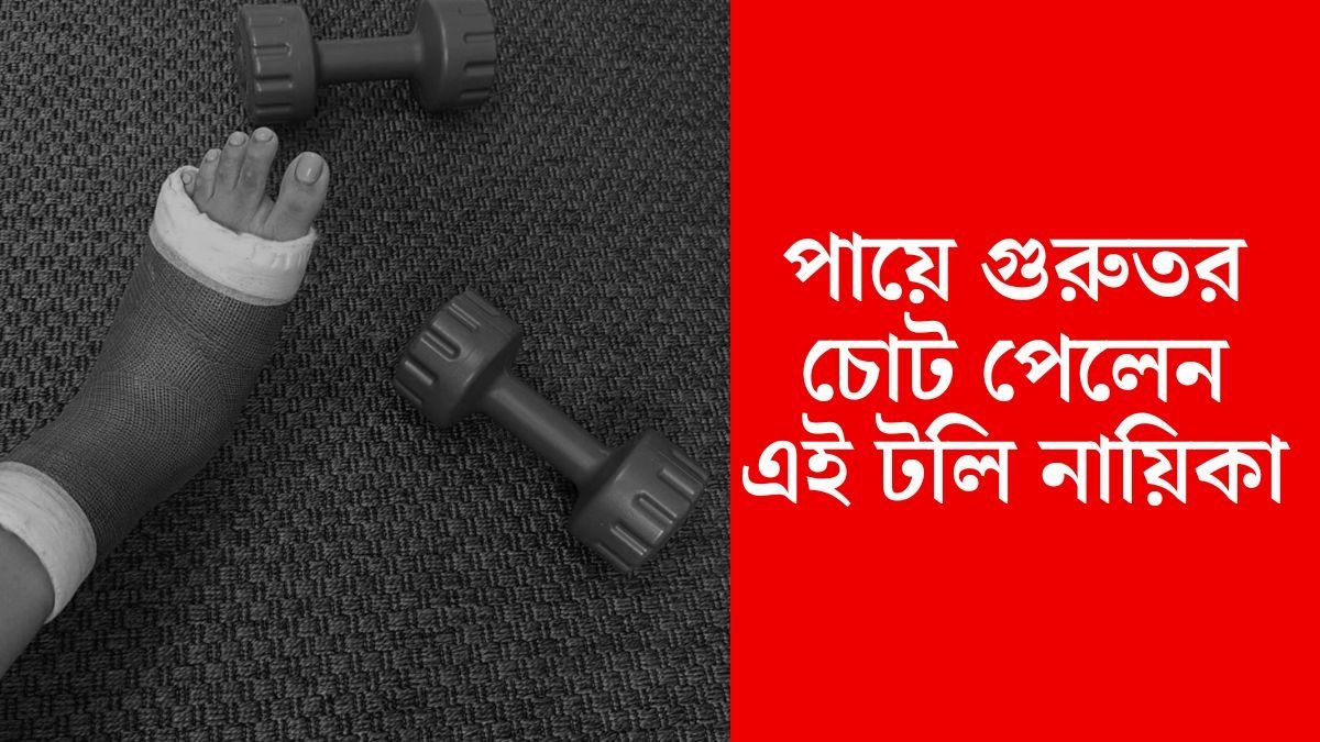 শুধু দেখা যাচ্ছে আঙুল, ফোলা পায়ে প্লাস্টার, কোন টলি নায়িকা চোট পেলেন? 