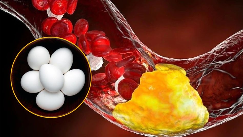 কোলেস্টেরল বেড়ে যাওয়ার ভয়ে ডিম খান না? গবেষণায় উঠে এসেছে এক চমকপ্রদ তথ্য কোলেস্টেরল বেড়ে যাওয়ার ভয়ে ডিম খান না? গবেষণায় উঠে এসেছে এক চমকপ্রদ তথ্য