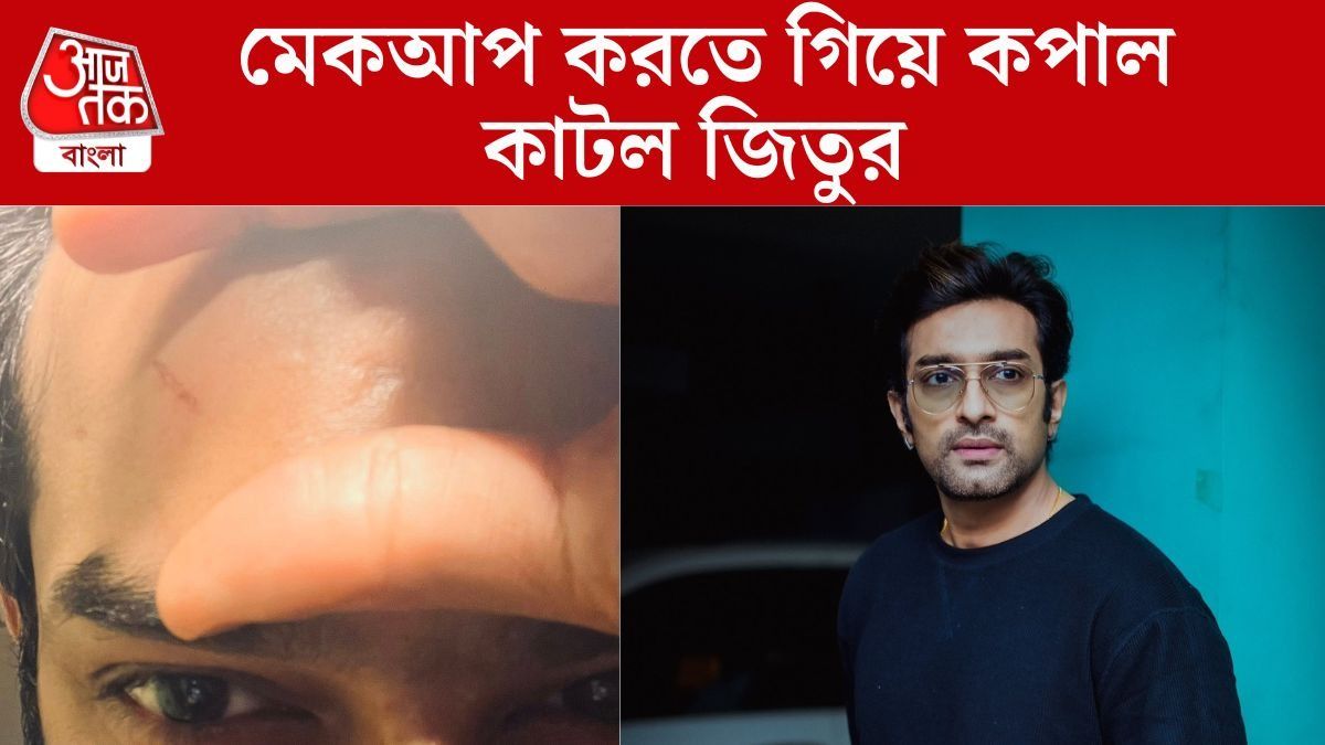 জিতুর কপাল কেটে রক্তারক্তি, মেকআপ আর্টিস্টের বিরুদ্ধে আইনি পথে অভিনেতা?