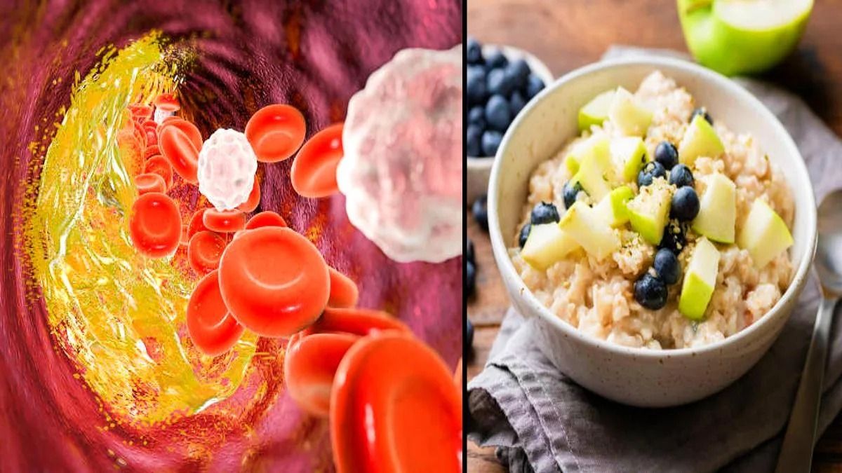 ব্যাড কোলেস্টেরলকে জব্দ করবে কোন কোন খাবার