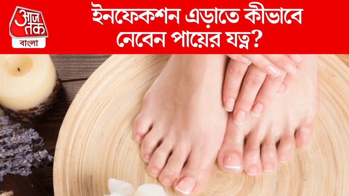 জমা জলে পা পড়তেই সংক্রমণ, বাড়ি ফিরে কীভাবে যত্ন নেবেন? 