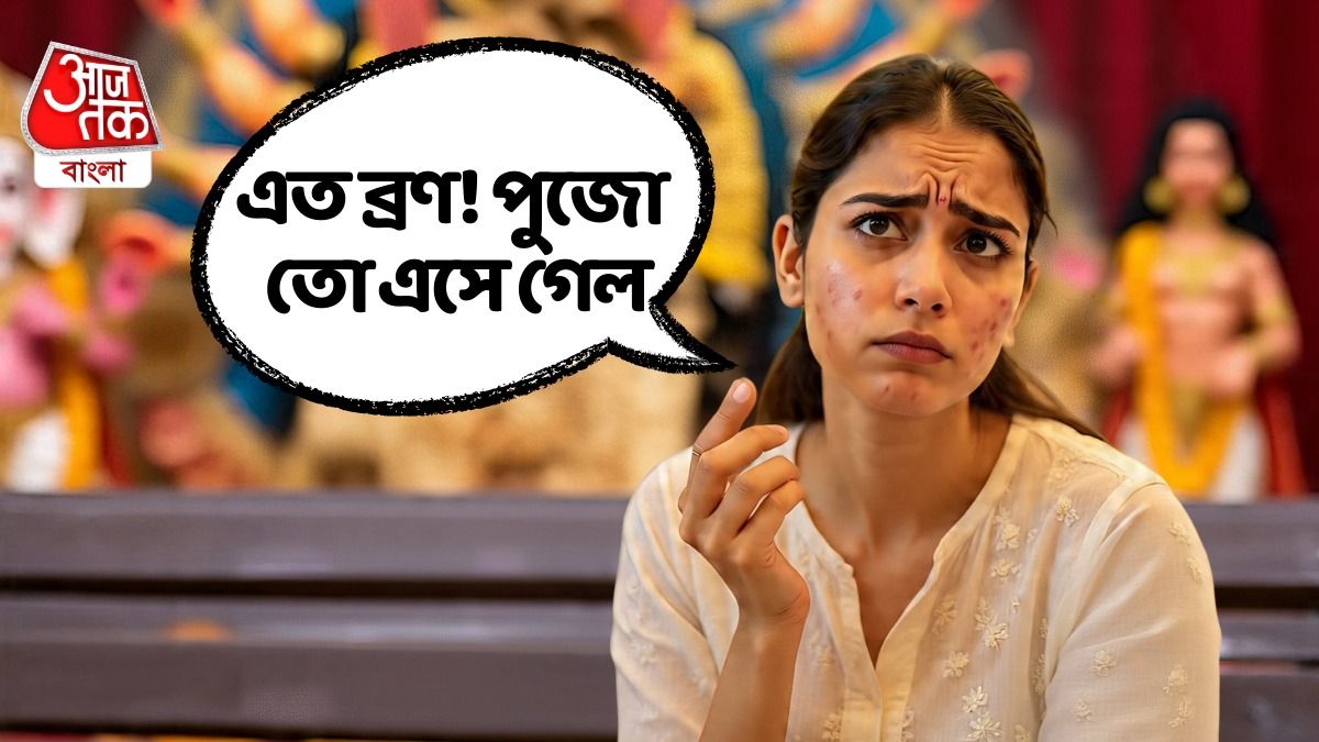 মাত্র দু'দিনেই মুখের সব ব্রণ গায়েব হবে, গ্ল্যামার ফেটে পড়বে, সস্তার ঘরোয়া টোটকা রইল