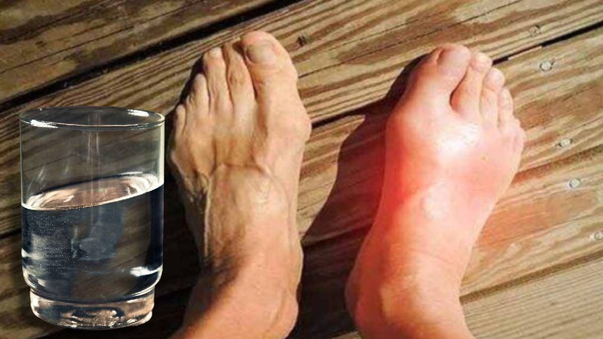 জলেই কমে যায় ইউরিক অ্যাসিড, ওষুধ না-ও লাগতে পারে, দিনে কত গ্লাস খাবেন?