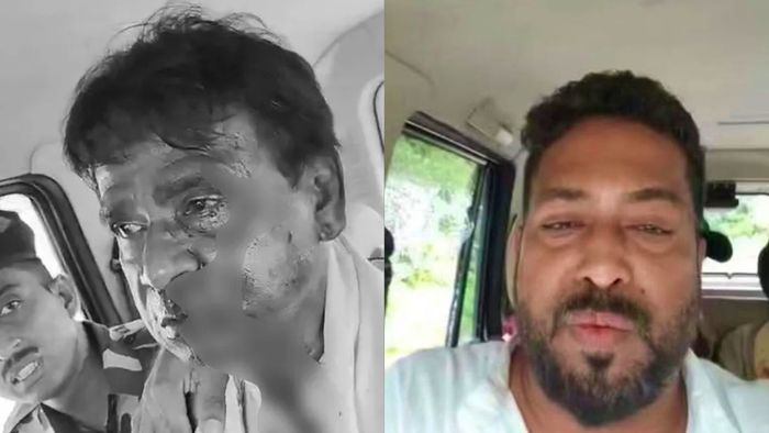 আহত খগেন মুর্মু (বাঁ দিকে), শঙ্কর ঘোষ (ডান দিকে)