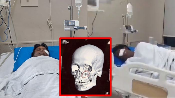 ICU-তে খগেন মুর্মু। এক্স রে প্লেট (ইনসেটে)