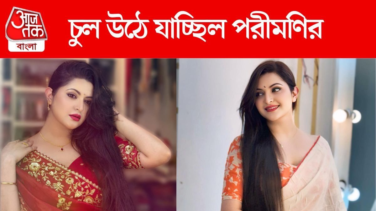 মাথার একপাশের চুল উঠে গিয়েছিল, কোন কঠিন রোগে আক্রান্ত ছিলেন নায়িকা?