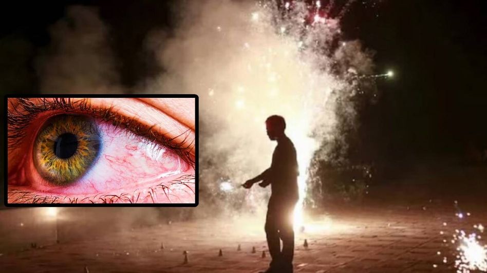 কালীপুজোয় চোখে বাজির ফুলকি ঢুকলে কী করবেন? রইল টিপস কালীপুজোয় চোখে বাজির ফুলকি ঢুকলে কী করবেন? রইল টিপস