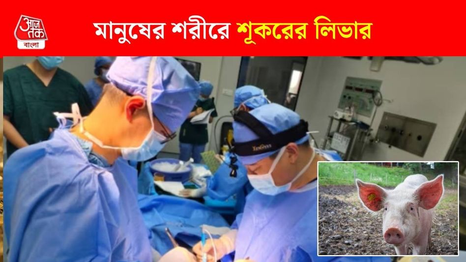 শূকরের লিভার মানুষের পেটে, বেঁচেও রইলেন, যত কাণ্ড চিনে শূকরের লিভার মানুষের পেটে, বেঁচেও রইলেন, যত কাণ্ড চিনে