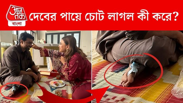 দেবের পায়ে চোট