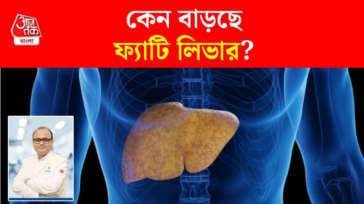 ফ্যাটি লিভারের কারণ