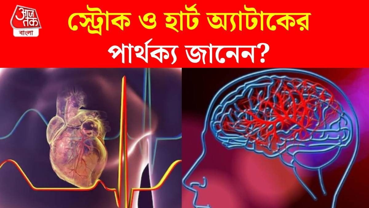 স্ট্রোক ও হার্ট অ্যাটাকের পার্থক্য কী? অনেকেই গুলিয়ে ফেলেন