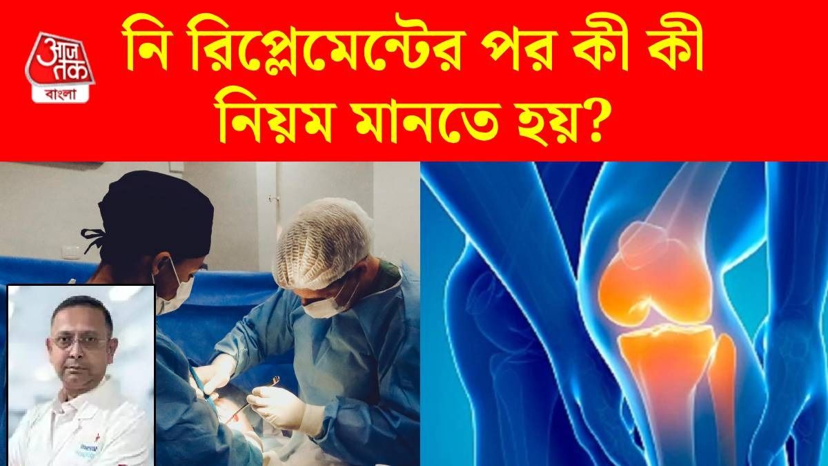 হাঁটু বা Knee Replacement-এর পর সারতে ঠিক কত দিন লাগে? জানালেন নামী অর্থো