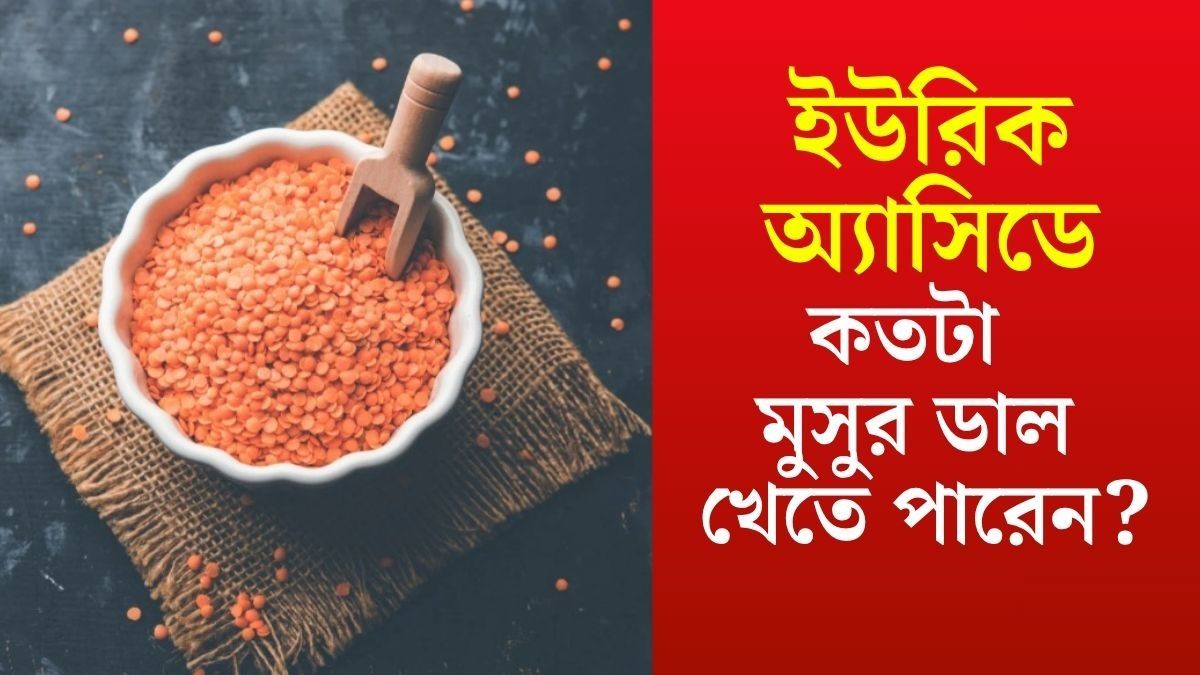 ইউরিক অ্যাসিডেও খাওয়া যায় মুসুর ডাল, কতটা খাবেন?