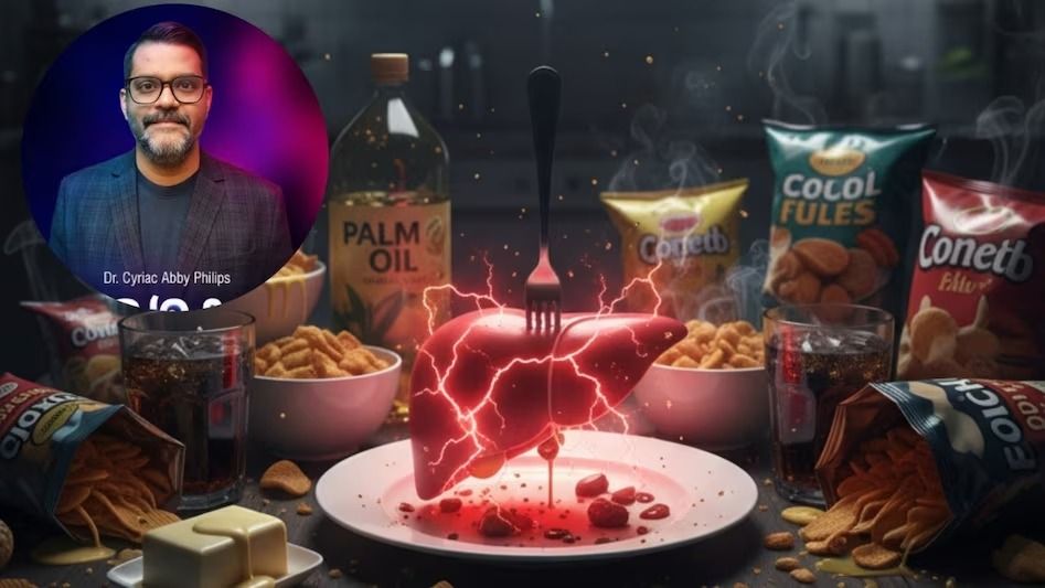 বড় ক্ষতি হচ্ছে লিভারের, আজই রোজের এই ৫ খাবার বাদ দিতে বললেন বিশেষজ্ঞ ডাক্তার 