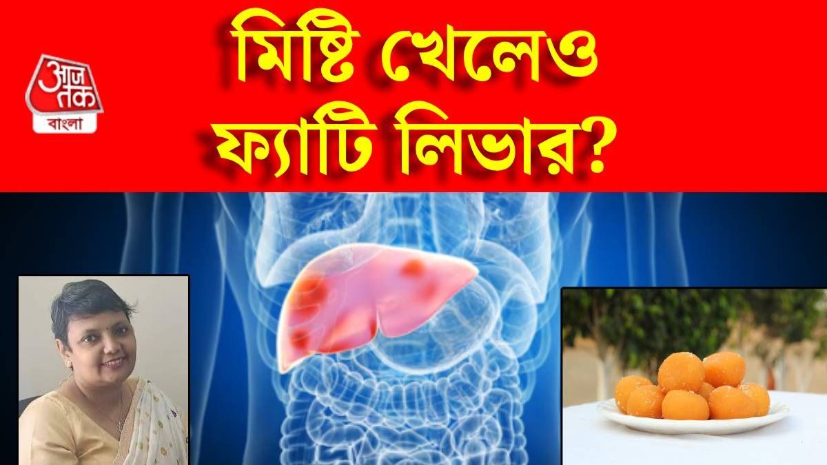 মিষ্টি খেলে কি হতে পারে ফ্যাটি লিভার? নামী ডায়েটিশিয়ান জানালেন সত্যিটা