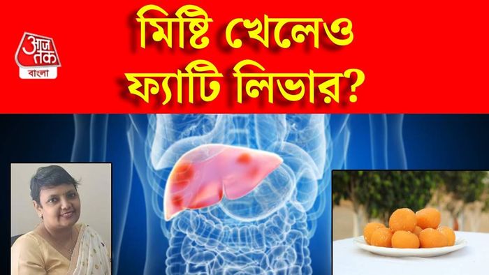 মিষ্টি খেলেও হতে পারে ফ্যাটি লিভার?