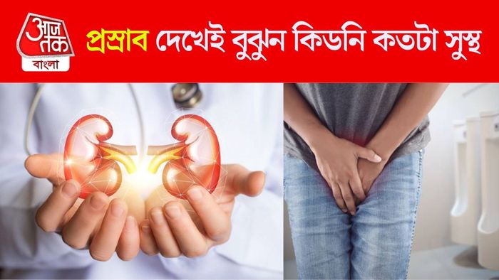 কিডনি সুস্থ রয়েছে কিনা বুঝুন এভাবে
