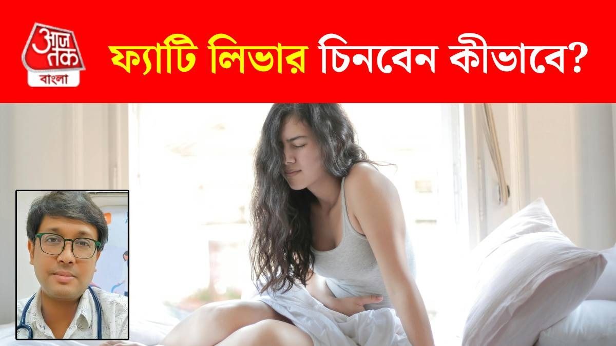 কোন কোন লক্ষণে বাড়ি বসেই চিনে ফেলবেন ফ্যাটি লিভার? জানালেন বিশিষ্ট ডাক্তার 