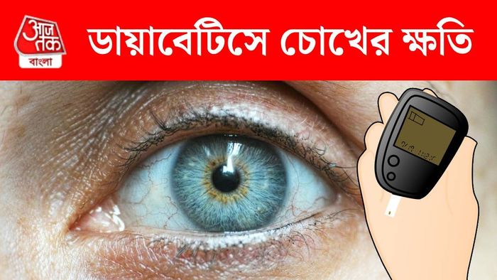 ডায়াবেটিক আই ডিজিজ