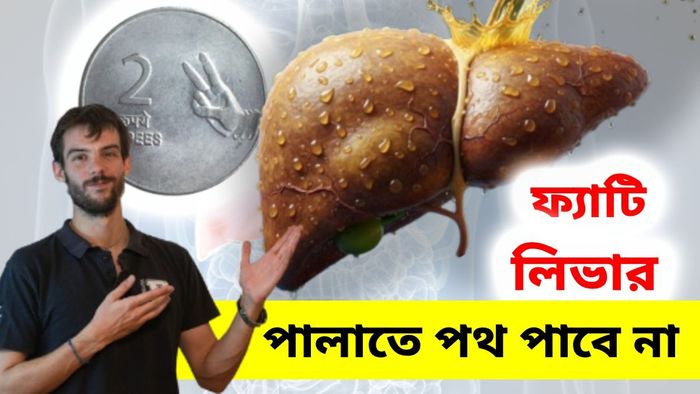 গলে যাবে লিভারের ফ্যাট
