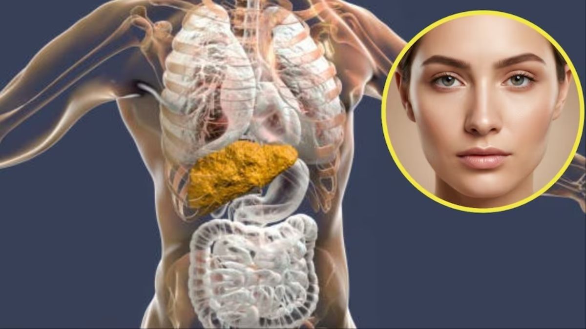 হতে লিভার ফেলিওর