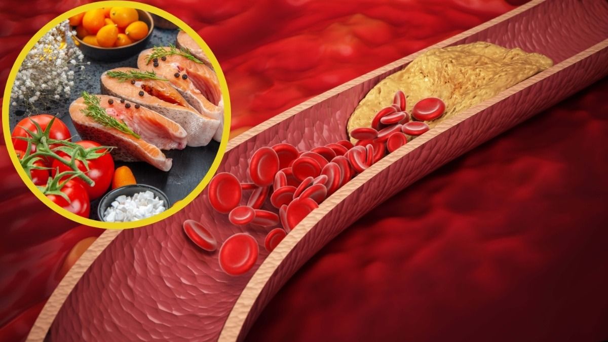 শিরায় জমে থাকা খারাপ কোলেস্টেরল দূর হবে, হার্ট বাঁচাতে এগুলো খান 