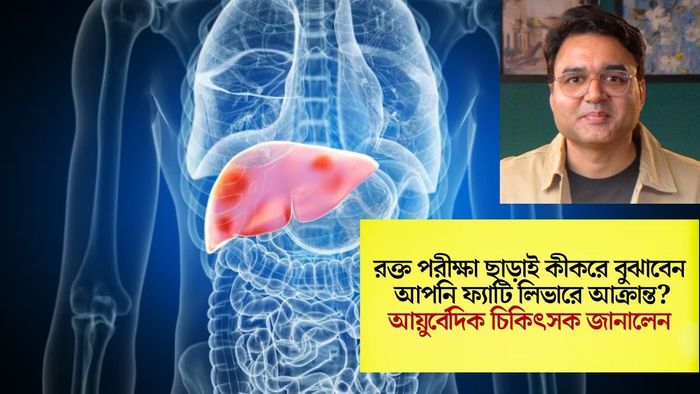রক্ত পরীক্ষা ছাড়াই কীকরে বুঝাবেন আপনি ফ্যাটি লিভারে আক্রান্ত?