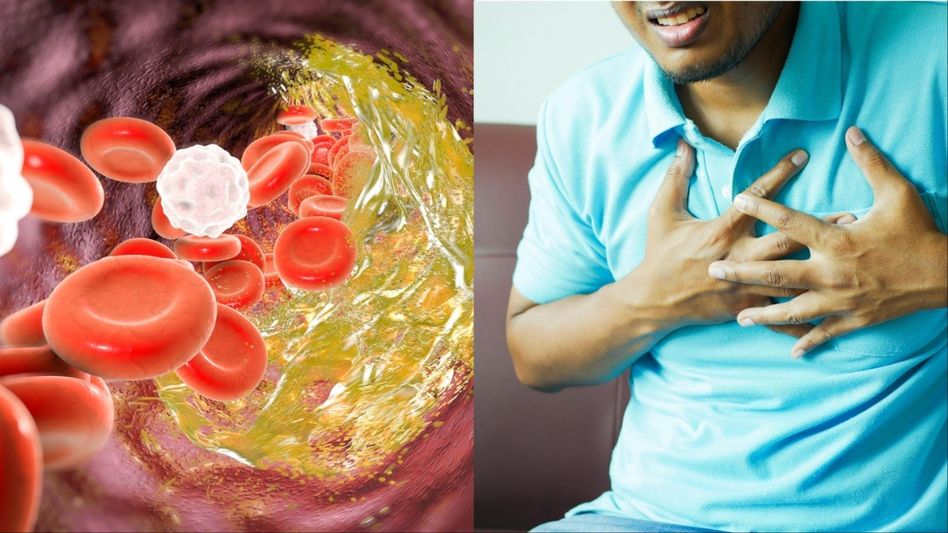 হার্ট অ্যাটাক রুখতে এই ৫টি খাবার রাখুন পাতে, রইল Heart-এর ডাক্তারের পরামর্শ হার্ট অ্যাটাক রুখতে এই ৫টি খাবার রাখুন পাতে, রইল Heart-এর ডাক্তারের পরামর্শ