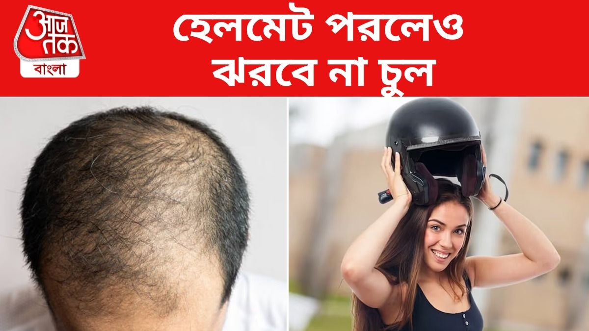 হেলমেট পরলেই চুল ঝরছে? এই ৪ টিপস মানলেই টাক পড়বে না 
