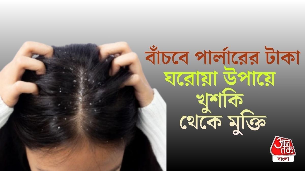 ঘরোয়া উপায়ে খুশকি দূর করার উপায়