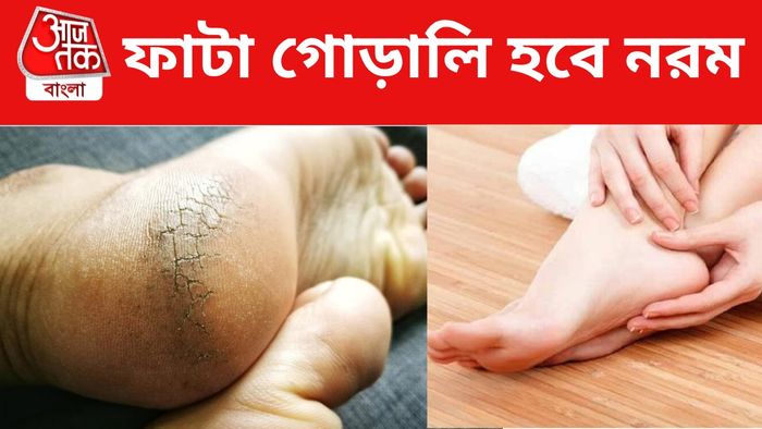 গোড়ালি