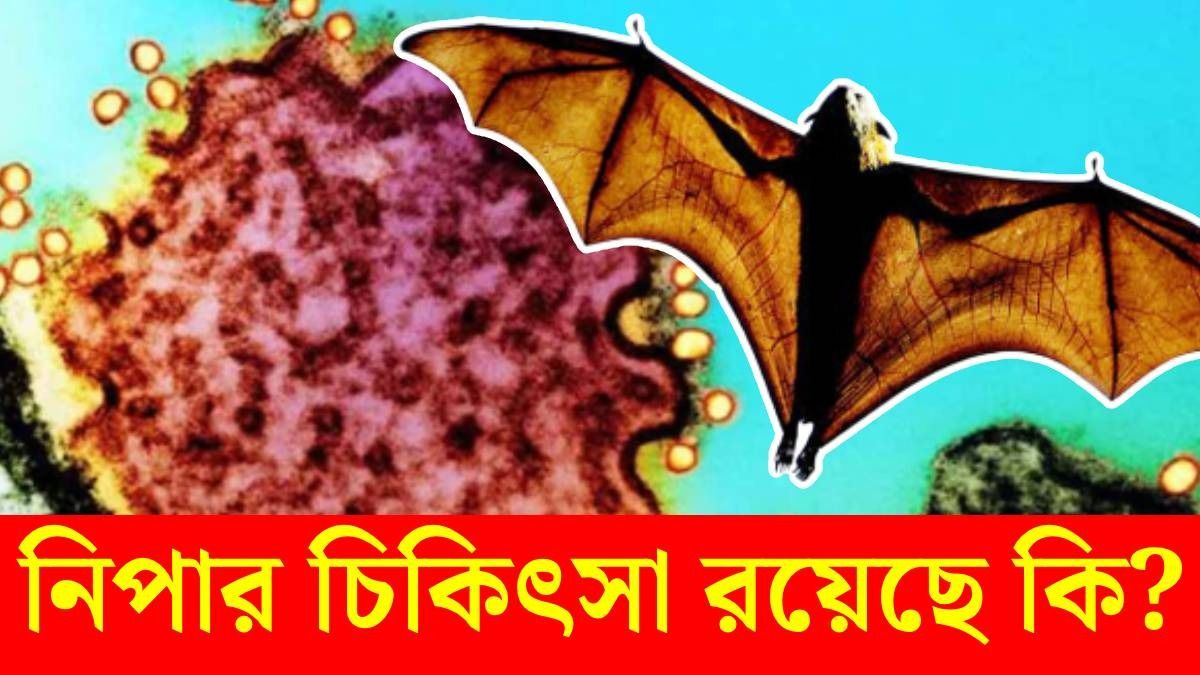 নিপা ভাইরাস আক্রান্তের লক্ষণ কী? কীভাবে প্রতিরোধ? বিশিষ্ট ডাক্তার যা বললেন...