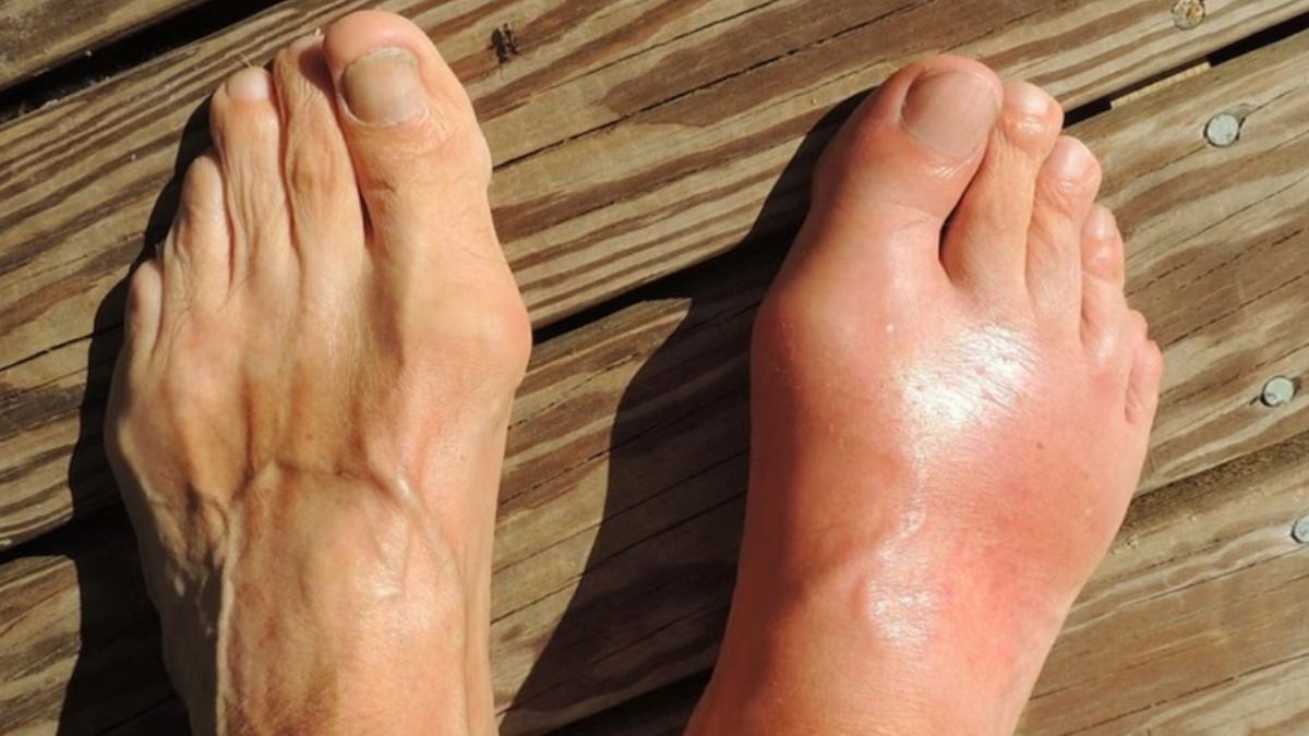 পায়ের দিকে তাকালেই ধরা পড়বে কিডনি, হার্টের রোগ, লক্ষণ বুঝে নিন