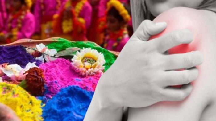 দোলে অ্যালার্জির চিকিৎসা