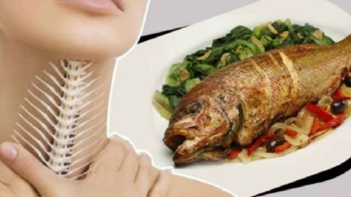 মাছের কাঁটা ফুটলে কী করবেন?