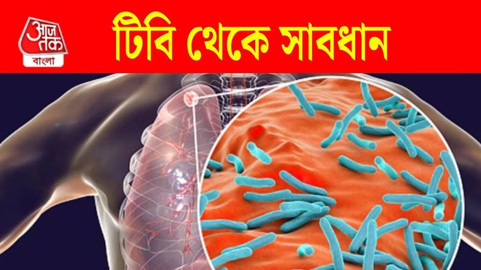 বিশ্ব টিবি দিবস