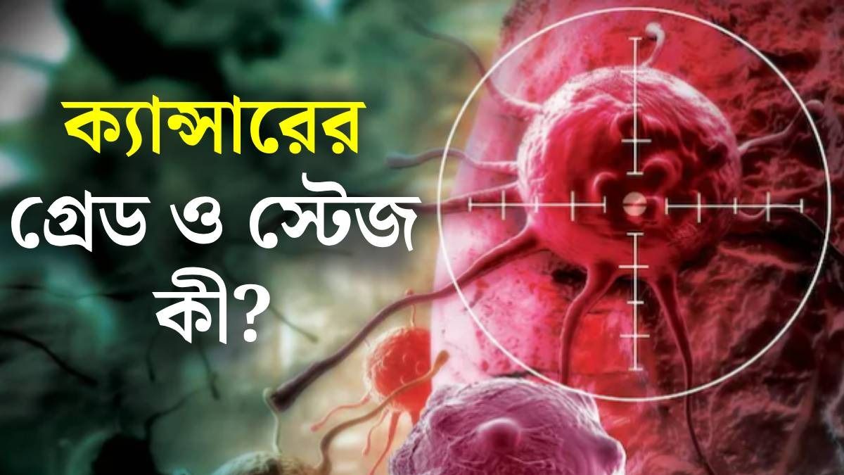 ক্যান্সারের গ্রেড এবং স্টেজ