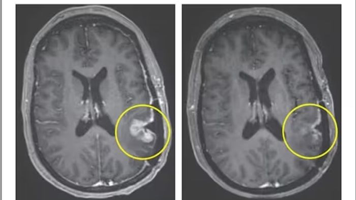 The New England Journal of Medicine-এ প্রকাশিত ছবি