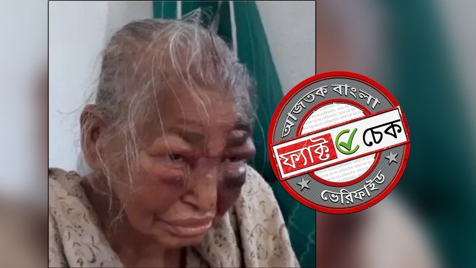 ফ্যাক্ট চেক: 'তৃণমূলের দ্বারা প্রহৃত' বৃদ্ধার ২০২১ সালের ছবি ছড়াল সম্পূর্ণ বিপরীত দাবিতে ফ্যাক্ট চেক: 'তৃণমূলের দ্বারা প্রহৃত' বৃদ্ধার ২০২১ সালের ছবি ছড়াল সম্পূর্ণ বিপরীত দাবিতে