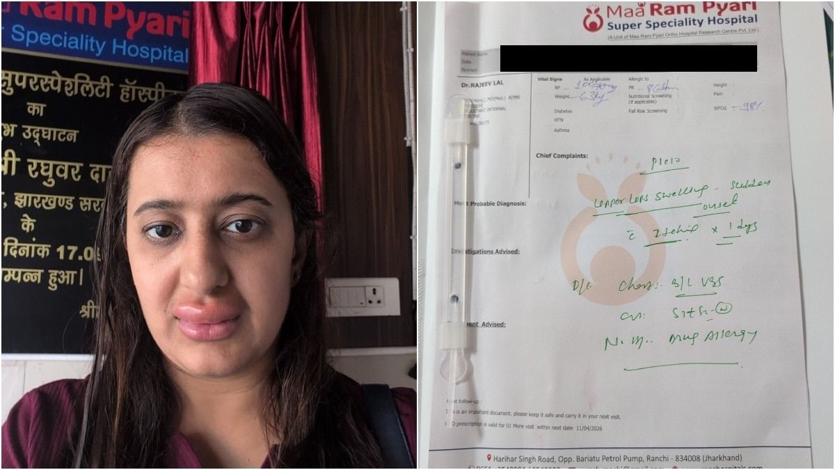 বন্দে ভারতের খাবার খেয়ে ঠোঁট ফুলে ঢোল মহিলার, শিশুর ডায়ারিয়া; দায়িত্ব নিল রেল?