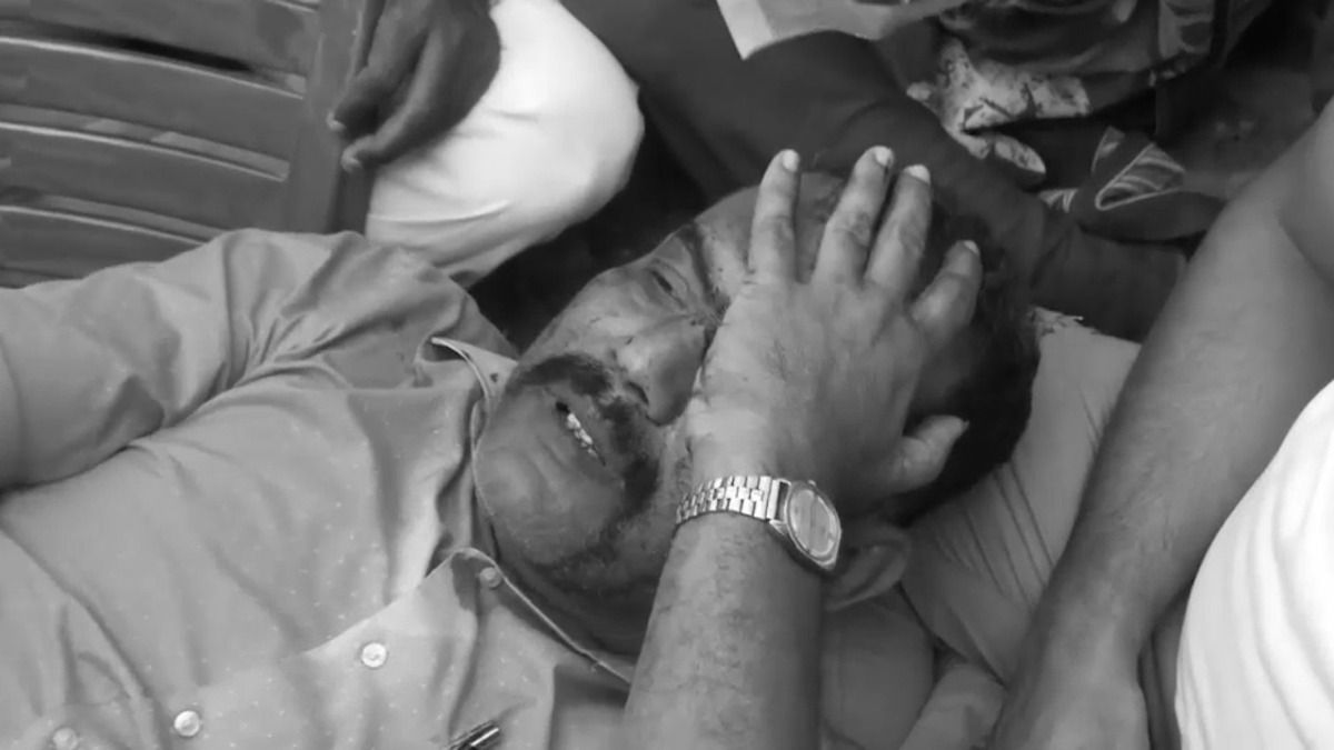 প্রার্থী অপছন্দ, বিধানভবনে বিক্ষোভ কংগ্রেসের একাংশের; ঝরল রক্ত 