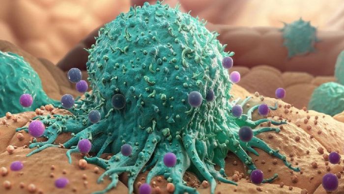 বায়োপসি করলে ক্যানসার ছড়ায়?