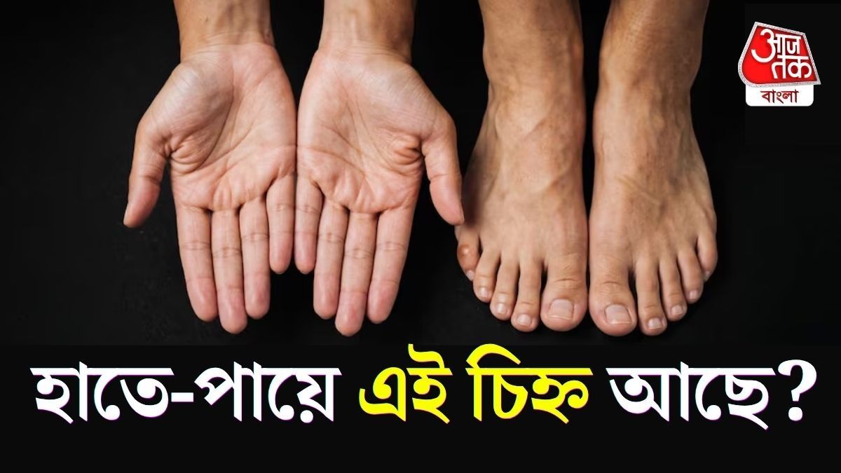 হাত ও পায়ে এই চিহ্নগুলি বিরল, দেরিতে হলেও সাফল্য নিশ্চিত