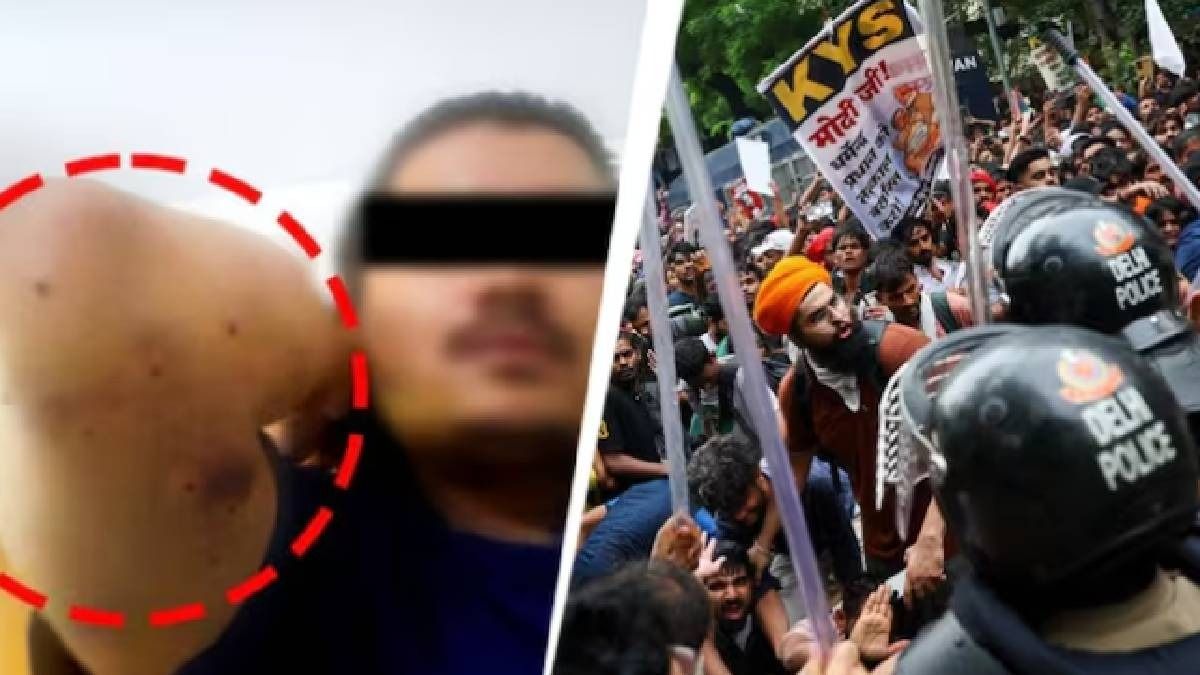 বিক্ষোভকারীদের দিকে সত্যিই ছোড়া হয়েছিল ছররা গুলি?