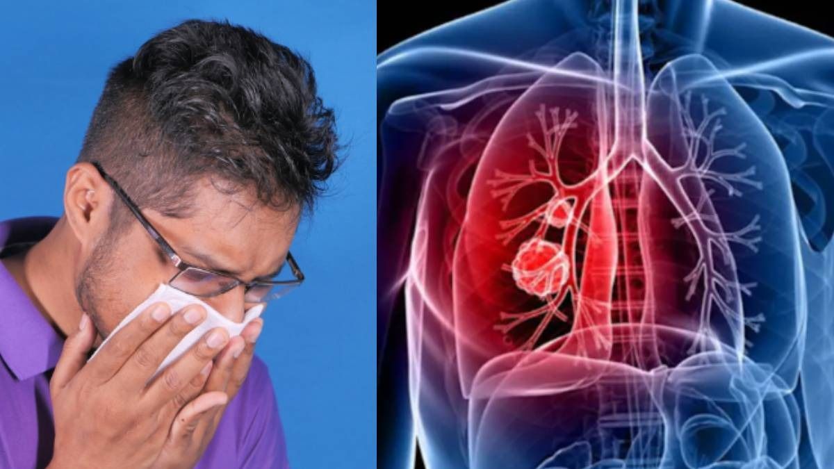 বিশ্ব ফুসফুসের ক্যান্সার দিবস