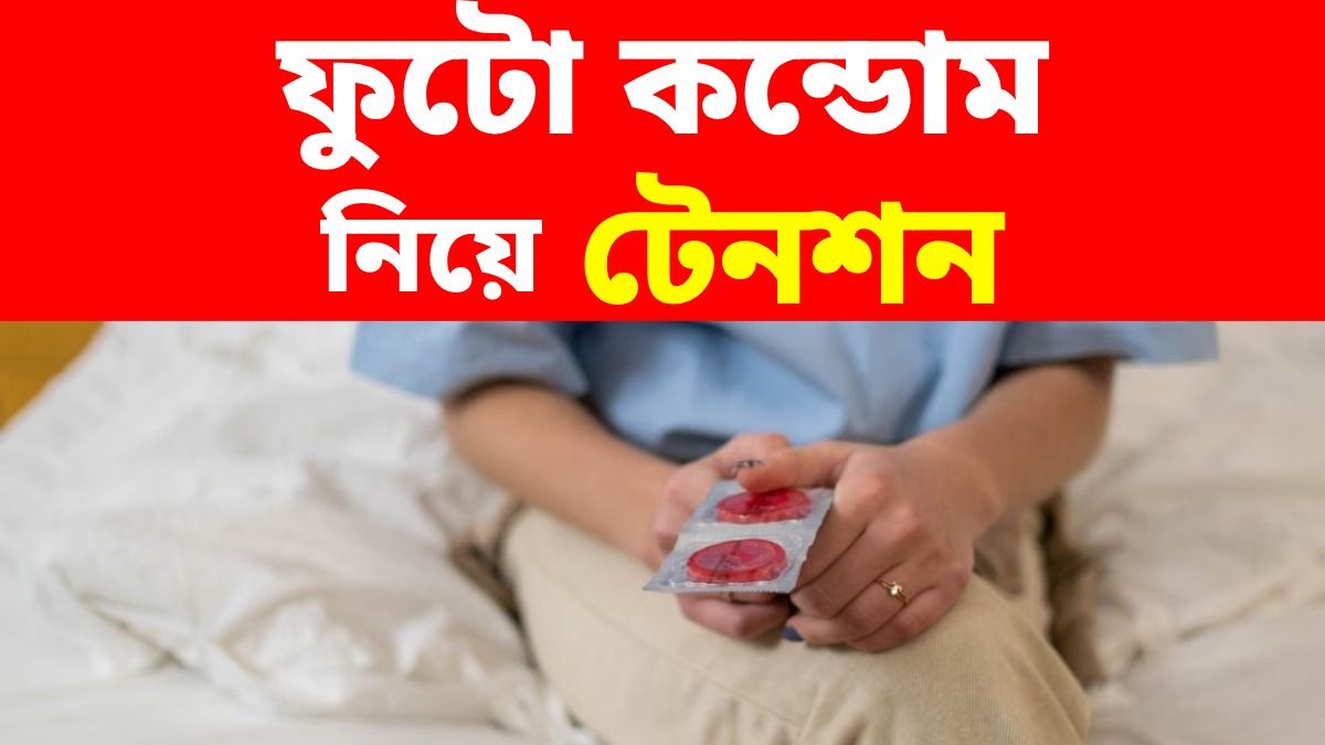 কন্ডোম নিয়ে মহাবিপাকে ফ্রান্স