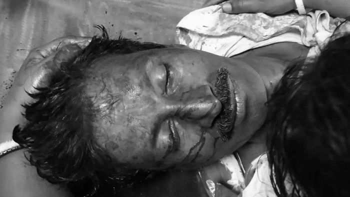 বোলপুরে বিজেপি নেতা চন্দন ভল্লার দেহ