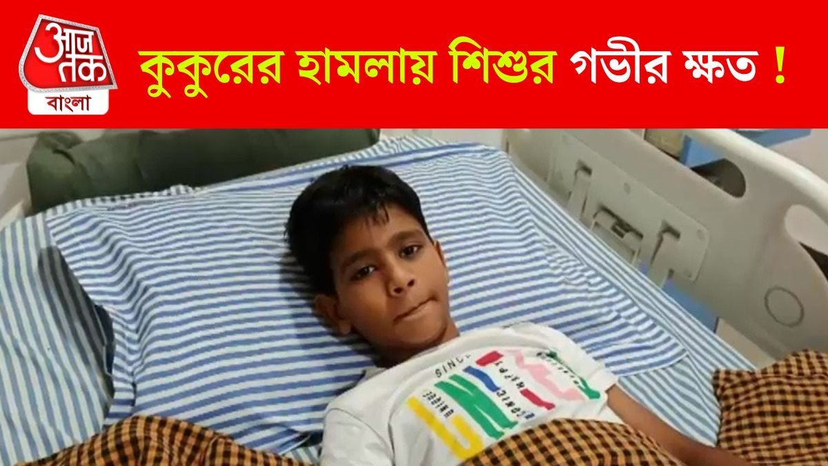 Bareilly Street Dog Attack