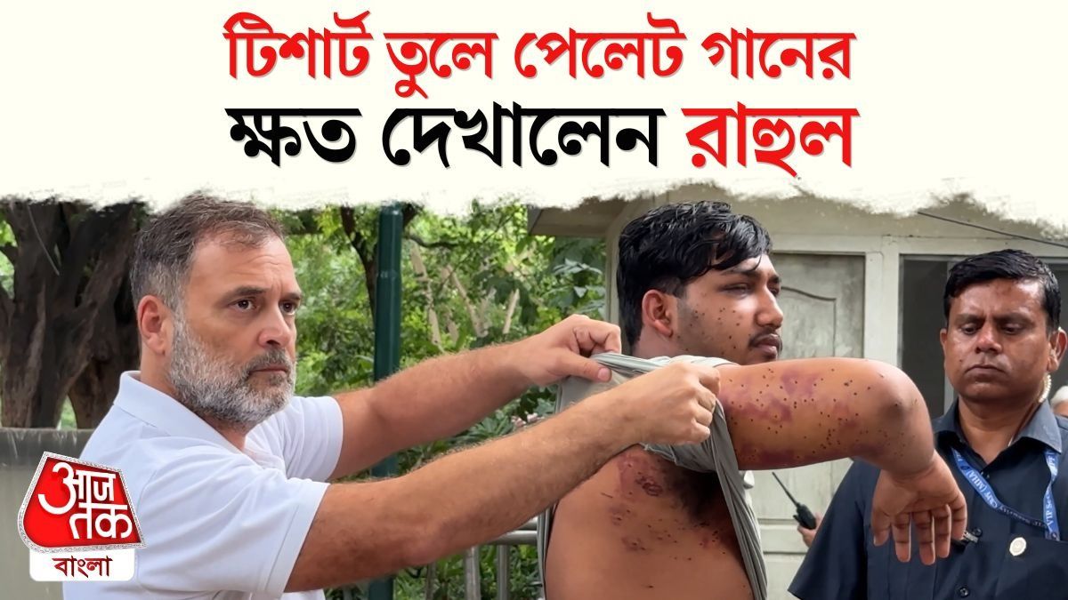 Pellet Gun এ আক্রান্তের আঘাত দেখালেন Rahul Gandhi, চাইলেন Dharmendra Pradhan Resignation