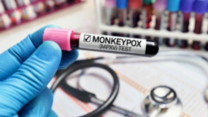 : मंकीपॉक्स से लड़ने के लिए निकाल दी है भारत ने RT-PCR KIT : मंकीपॉक्स से लड़ने के लिए निकाल दी है भारत ने RT-PCR KIT